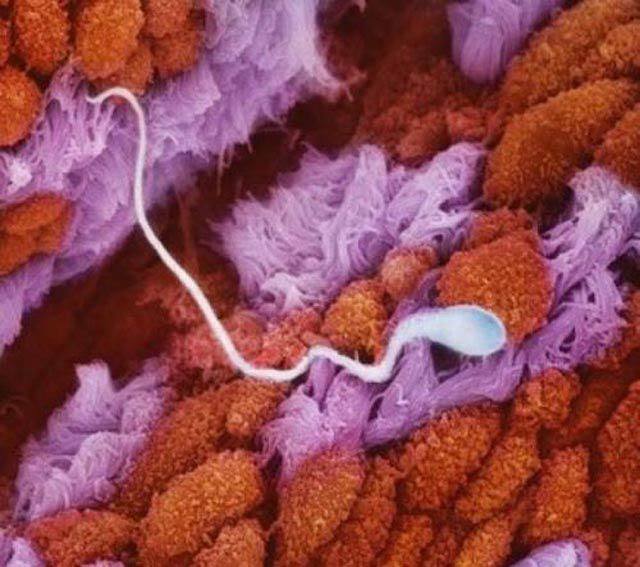 Sperm in the Fallopian Tube..!!