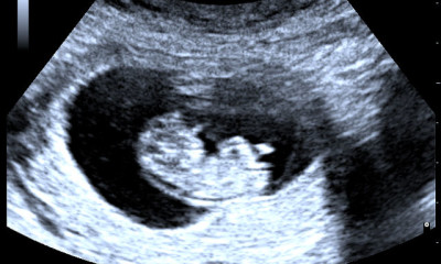 jumping fetus in womb viral