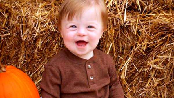 John-David-down-syndrome baby viral abc