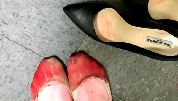 Waitress’ Bloodied Feet after Being Forced to Wear Heels Goes Viral